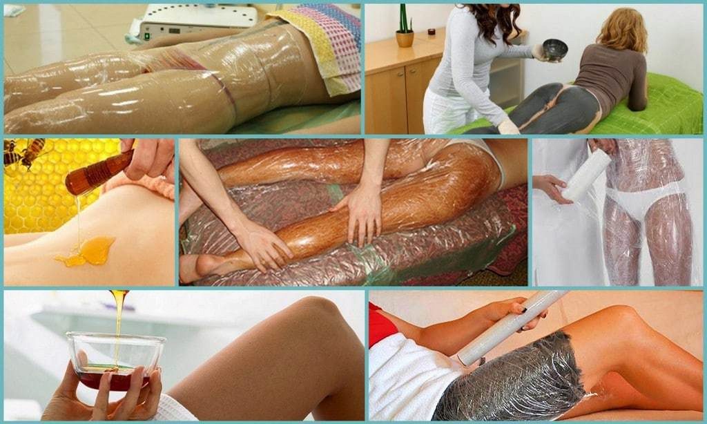 Антицеллюлитное холодное обертывание купить со скидкой в секс шопе  Косметика  Уход за телом